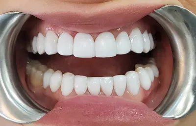 Klinika Uśmiechu - Dentysta Chorzów | Implanty, Bonding